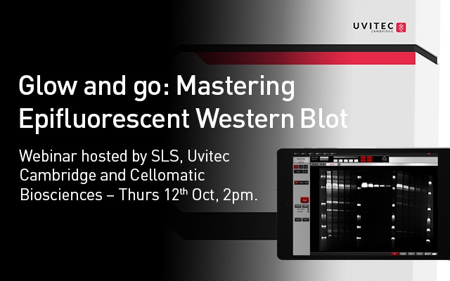 Glow and go: Mastering Epifluorescent Western Blot